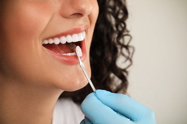 Ask A Cosmetic Dentist: Bonding Vs  Veneers