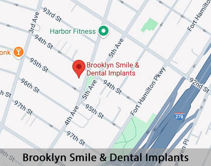 Map image for What Can I Do to Improve My Smile in Brooklyn, NY